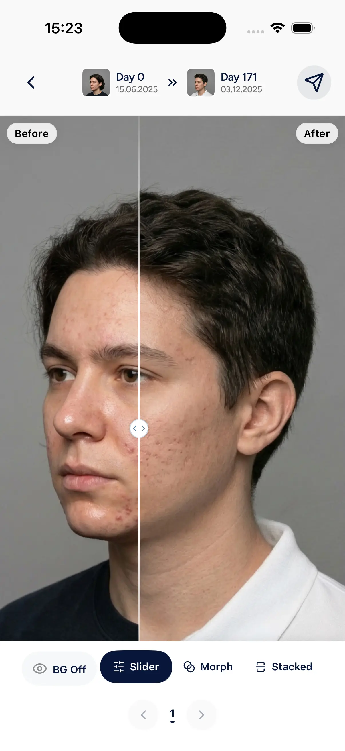 Patient app slider preview